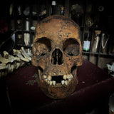 Human skull