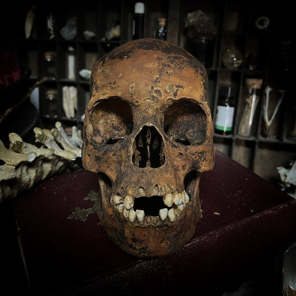 Human skull