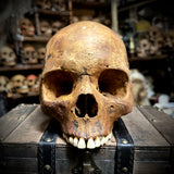 Human skull