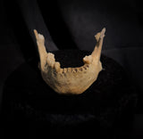 A mandible