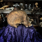 Human skull