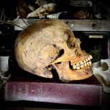 Human skull with mandible