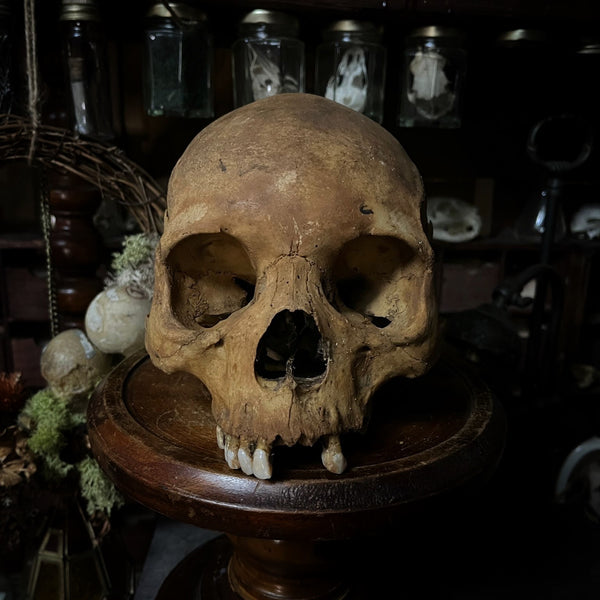 Human skull