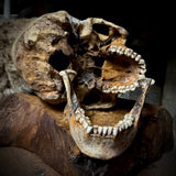 Large human skull with mandible