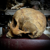 Human skull