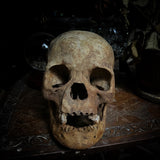 Human skull