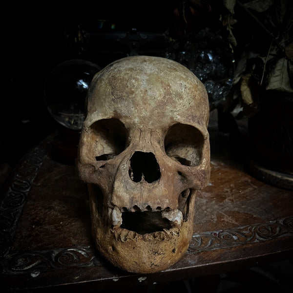 Human skull