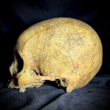 Item 14. Human skull