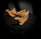 A mandible