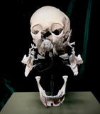 Adam Rouilly Exploded skull