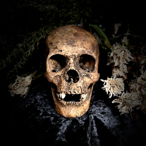 A human skull with mandible
