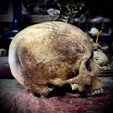 Human skull
