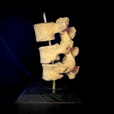 Item 10. Triple vert stand