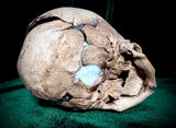 Human fetal skull