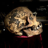 A human skull with mandible