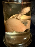 Item 3. Fetal lungs and heart