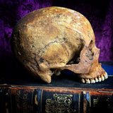 A human skull