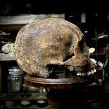 Human skull