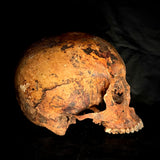 Item 7. Human skull