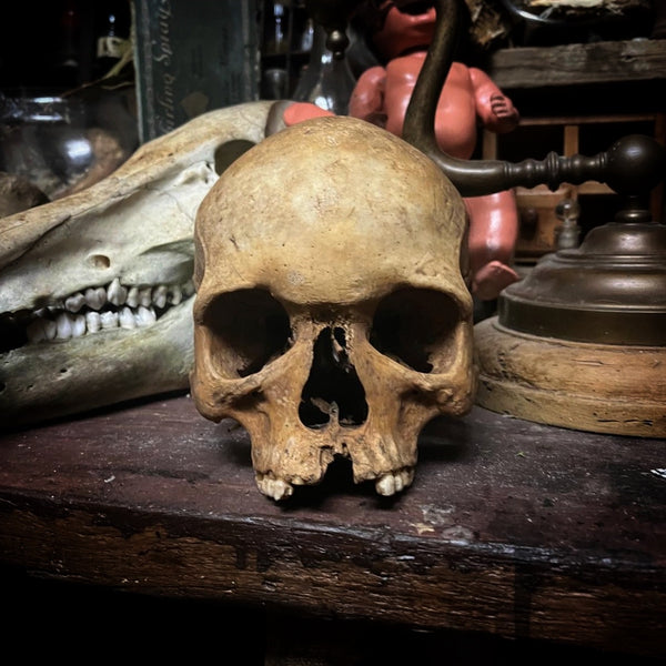 Human skull