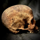 A human skull