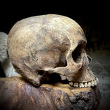 Human skull
