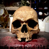 Human skull