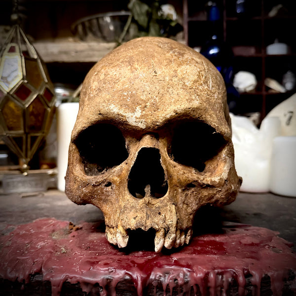 Human skull