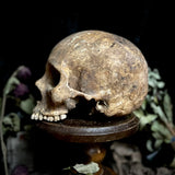 A human skull
