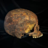 Item 1. Human skull