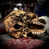 Human skull