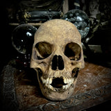 Human skull with mandible