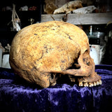 Human skull