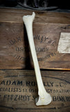 Human tibia (shinbone)