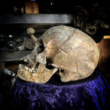 Human skull