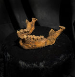 A mandible