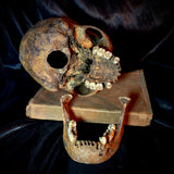 Item 20. Human skull with mandible