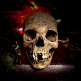 A human skull with mandible