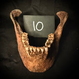 Item 10. Human mandible