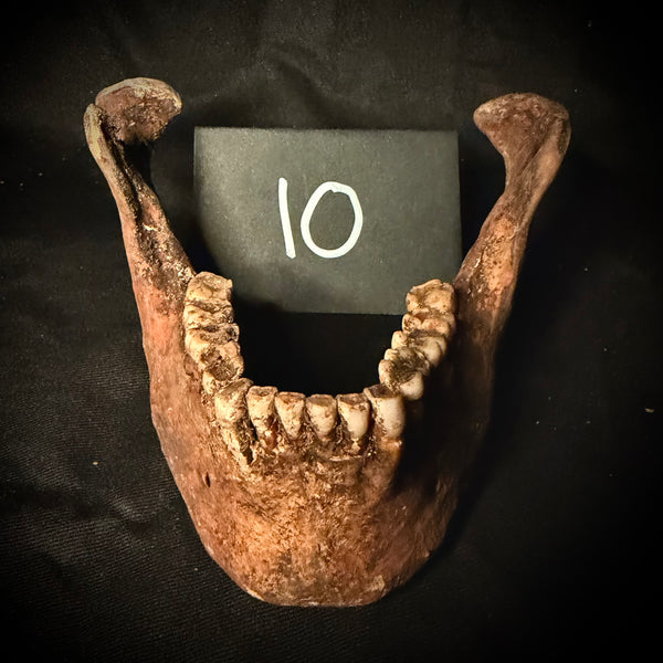 Item 10. Human mandible