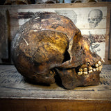 Human skull with mandible