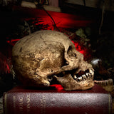 A human skull with mandible