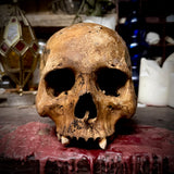 Human skull with trauma