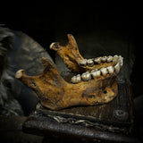 A mandible