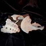 Item 4. Human bone lot