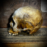 Human skull