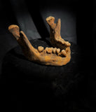 A mandible
