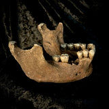A mandible