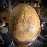 Human skull