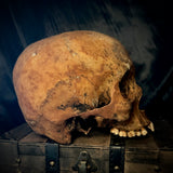 Item 3. Human skull